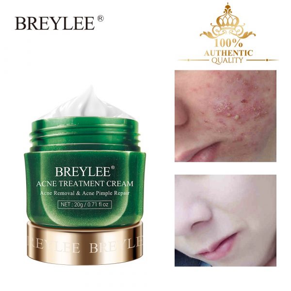 BREYLEE Acne Treatment Cream, Acne Removal & Acne Pimple Repair