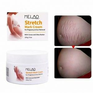 Melao Stretch Mark Cream For Pregnancy & Scar Removal 120g